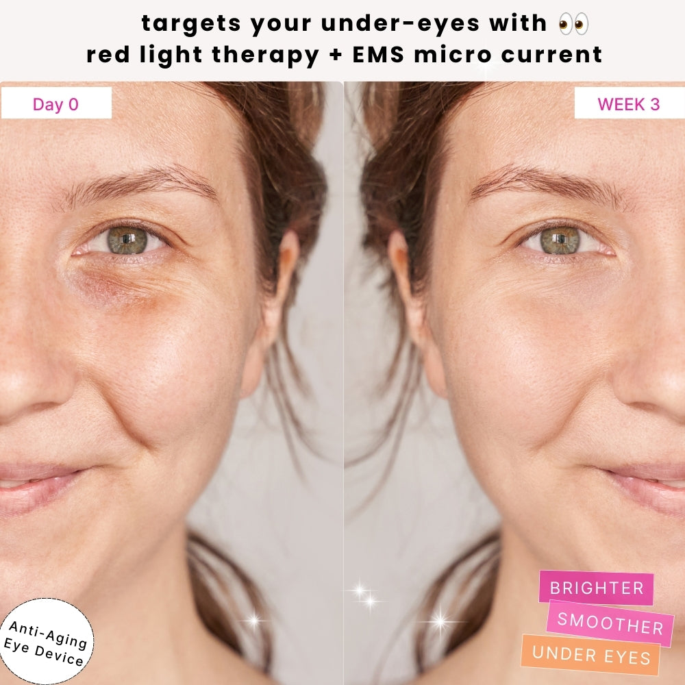 RejuvenEyes Under-Eye Red Light Therapy
