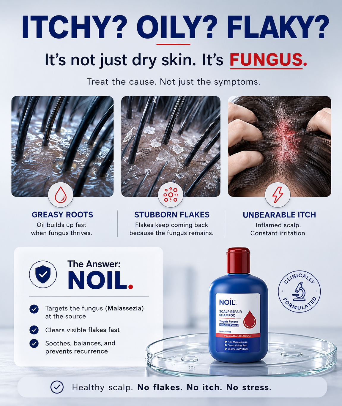 Selenium Disulfide Anti-Dandruff Shampoo