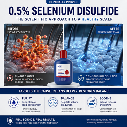 Selenium Disulfide Anti-Dandruff Shampoo