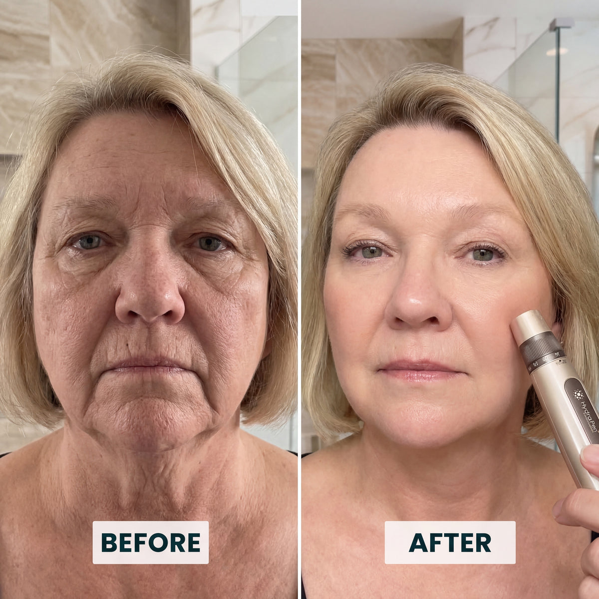 Hydra Pen H5 Professional Microneedling Pen